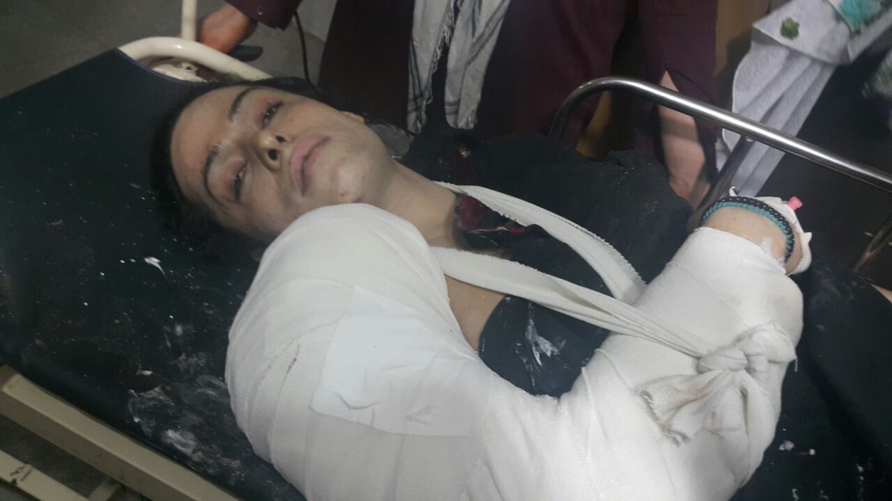 Transgender activist critically injured after being shot multiple times in  Peshawar