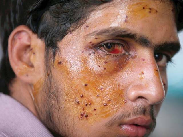 Govt should determine use of pellet guns in occupied-Kashmir, not Indian  SC: Yashwant Sinha | The Express Tribune