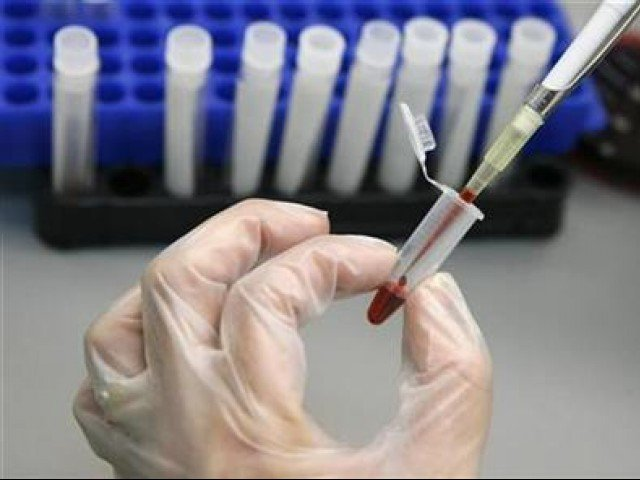 'Dangerous complacency' looms over world AIDS meeting.
PHOTO:REUTERS