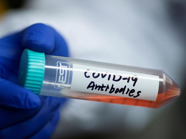 A scientist shows a tube with a solution containing COVID-19 antibodies in his lab where he works on research into novel coronavirus disease (COVID-19) antibodies for possible use in a drug at Tsinghua University's Research Center for Public Health in Beijing, China. PHOTO: REUTERS