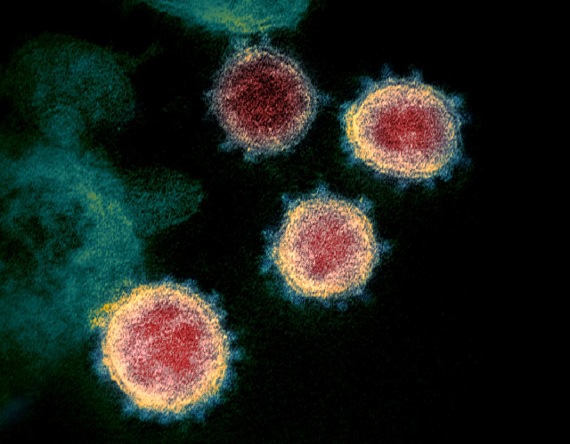 This undated transmission electron microscope image shows SARS-CoV-2, also known as novel coronavirus, the virus that causes COVID-19, isolated from a patient in the US Virus particles are shown emerging from the surface of cells cultured in the lab. The spikes on the outer edge of the virus particles give coronaviruses their name, crown-like. PHOTO: REUTERS